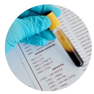 Hashimoto Laborwerte